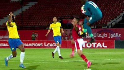 محمد شريف ينشر صورة لآثار قدم حارس مرمى صن داونز على ظهره