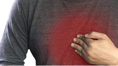 بعد أكلات العيد أطعمة تخلصك من حموضة المعدة