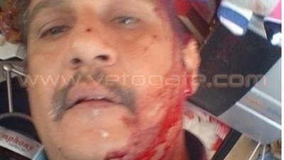 محاولة اغتيال مرشح برلماني في كفر الشيخ