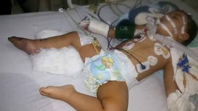 بالصور.. والد الطفل ضحية الإهمال الطبي يناشد السيسي بإنقاذ نجله