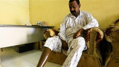 خبراء: زيادة حالات بتر الأطراف بين مرضى السكر في نيجيريا