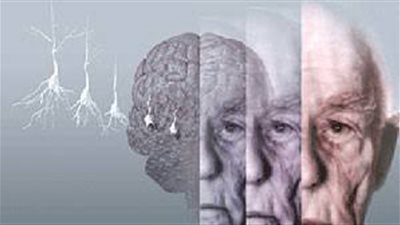 ألزهايمر ثاني أكثر الأمراض إثارة للرعب بين الفرنسيين