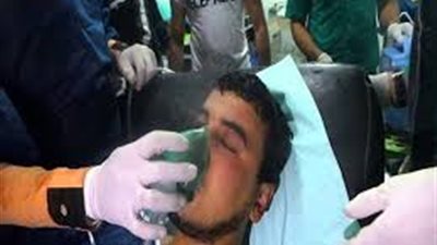 «البيئة»: تعافي المصابين بالاختناق في المنطقة الصناعية بكوم أوشيم