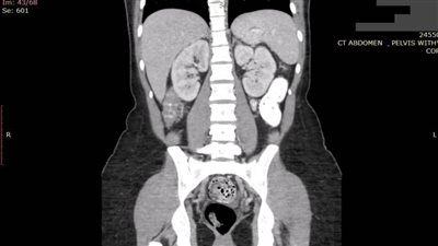 تسريب أكثر من مليار صور طبية على الإنترنت بسبب إهمال الأطباء | صور