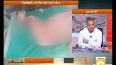 والد الرضيع ضحية الإهمال يروي تفاصيل حرقه في مركز صحي بالمنوفية