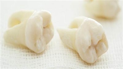 تفسير حلم سقوط الضرس في المنام عند ابن سرين