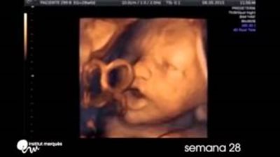 بالفيديو.. جنين يرقص ويغني على أنغام الموسيقى