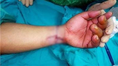 أزمة نفسية وراء انتحار فتاة التبين