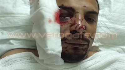 وزير القوى العاملة يتابع حالة مواطن مصري أصيب بطلق ناري في الكويت