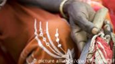 ارتفاع أعداد النساء المختونات في ألمانيا والسبب