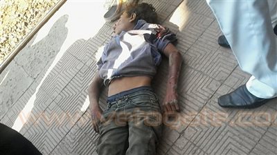 إصابة طفل بجروح خطيرة عقب اصطدامه بكوبري محطة قطار شبرا