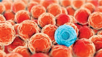 دراسة: السرطان ينتقل إلى مناطق أخرى بواسطة الكوليسترول