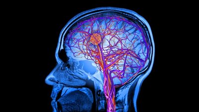 دراسة: المخ سبب حب البعض «إضافة الملح للطعام»