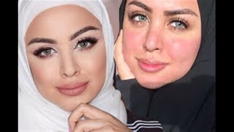 فيتو