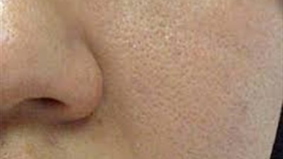 النظافة والطعام الصحي طريقك للحفاظ على نضارة بشرتك