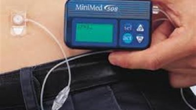 الدواء الأمريكية تصدق على أول بنكرياس صناعي لمرضى السكر النوع الأول