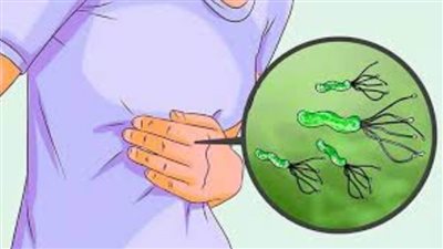 كل ما تريد معرفته عن جرثومة المعدة