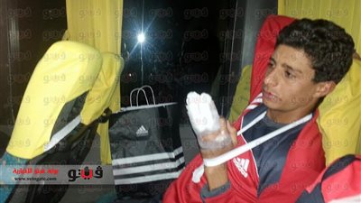 إصابة لاعب الرجاء بكسر مضاعف باليد