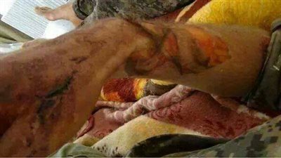 بالصور.. نشطاء: 