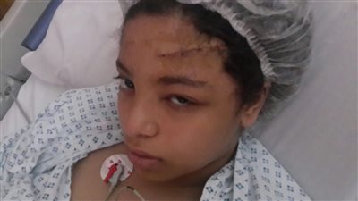 «مدارس مصر طريقك للآخرة».. طفلة تصاب بنزيف في المخ بعد سقوط مروحة على رأسها.. عارضة ملعب تتسبب في مصرع تلميذ بالمنيا.. قطع أوتار آخر نتيجة سقوط لوح زجاجي عليه بالمنصورة..وبوابة مدرسة تقتل طا