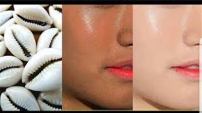 أقوى ماسك للتخلص من الكلف والاسمرار (فيديو)