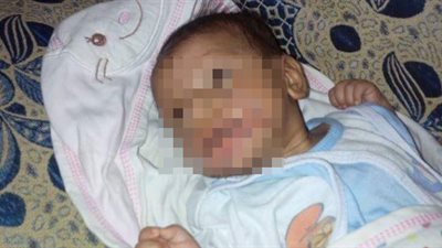 حبس والدة طفل «العضة» بالإسماعيلية 45 يوما على ذمة التحقيقات