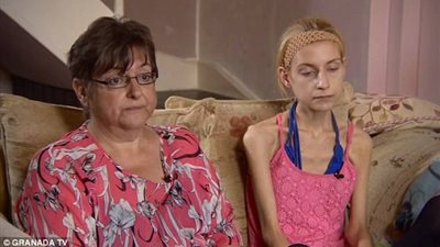 بالصور.. أم يائسة تساعد ابنتها التي فقدت الشهية بعد فشل أعضائها