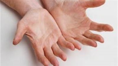 الدولة تدشن الحملة القومية «إحساسك نعمة» لعلاج التهاب الأعصاب الطرفية.. إطلاق 200 قافلة طبية للتوعية بخطورة المرض.. ووزيرة الصحة: نستهدف علاج 200 ألف مريض بالمجان.. والأنسولين متوفر لمرضى ال