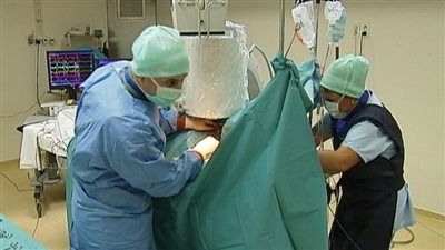 استخدام الذكاء الاصطناعي لقهر مرض الزهايمر