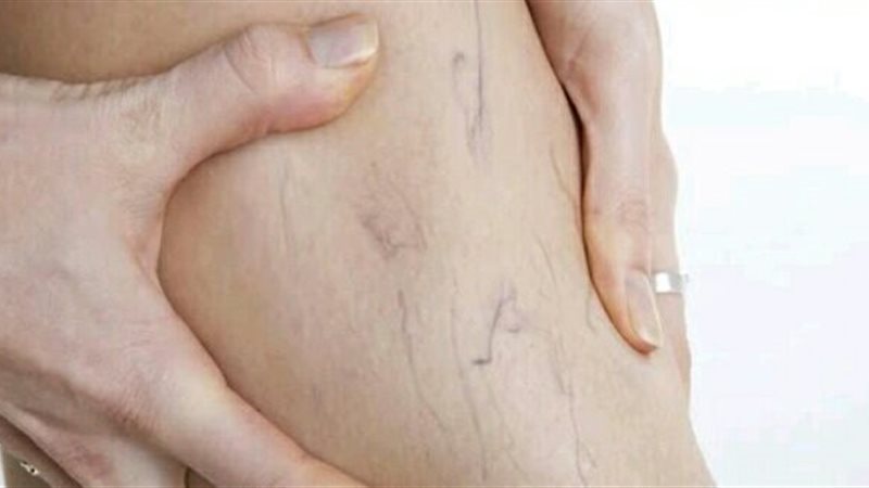 صورة ارشيفيه