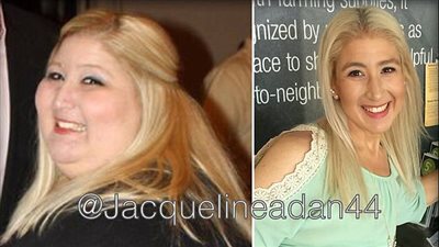 بالصور.. امرأة تشعر بخيبة أمل بعد فقدان 159 كيلو جراما من وزنها