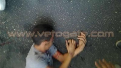 سيارة تصدم طالبا أمام بوابة جامعة الأزهر