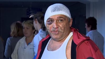 بالصور.. شمبانزي غيور يقطع أذن حارس حديقة غازل زوجته