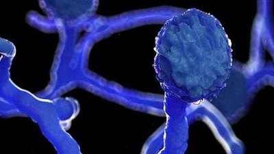 رئيس لجنة مكافحة كورونا: اكتشفنا حالتين مصابتين بالفطر الأسود