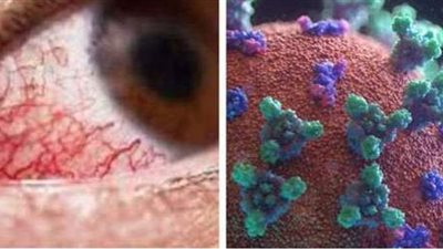 المرض القاتل.. أبرز 10 معلومات عن الفطر الأسود