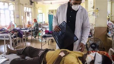 باحث في الفيروسات يكشف مفاجأة بشان الفطر الأسود: موجود فى كل مكان| فيديو