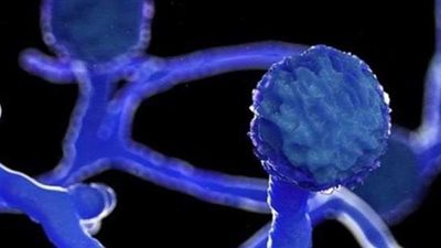 أمراض تصيب المتعافين من كورونا.. الفطر الأسود «قاتل صامت» و«الأبيض» أكثر فتكًا.. والعقم وتعفن الدم «بالقائمة»