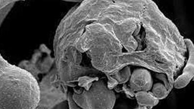 استشاري حساسية يكشف مخاطر استخدام المضادات الحيوية دون استشارة الطبيب