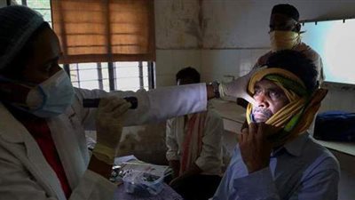 بعد إصابة 11 ألف مواطن.. الهند تعلن الفطر الأسود 