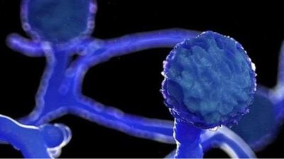 إحالة طبيبة بالشرقية للتحقيق بسبب منشور على 