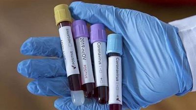 عالم أمريكي يصدم العالم: انتظروا كوفيد-26 وكوفيد-32