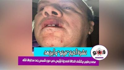 أخبار مصر: بيان كورونا.. مصرع 