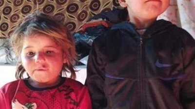 مكبلة بالحديد .. صورة طفلة سورية قبل وفاتها جوعًا تبكي العالم