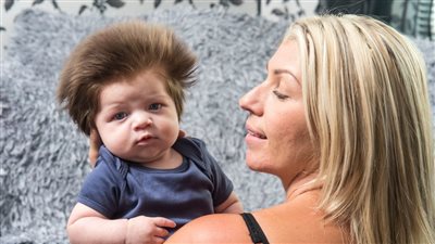 بالفيديو والصور.. رضيع يثير جدلا حول كثافة شعره