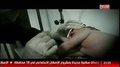 بالفيديو.. تعذيب طفلة داخل مستشفى بـ«فيصل»