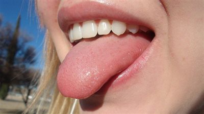 أسرع طرق العناية بصحة اللسان