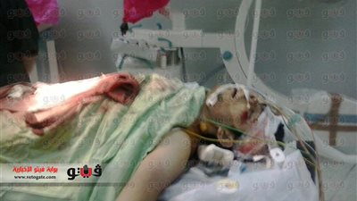 بلاغ للنائب العام.. «محمد» دخل مستشفى «إمبابة» مصابًا فخرج «دون طحال ومخ بارز».. شقيقته: النزيف استمر «ساعة ونصف» ولا يوجد أطباء.. والدتى «قبلت» يد ال