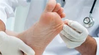 أسباب الإصابة بالقدم السكري وطرق العلاج