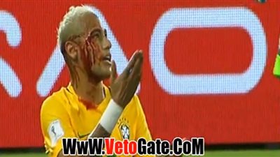 بالفيديو.. «نيمار» ينزف الدماء خلال مباراة «البرازيل» و«بوليفيا»