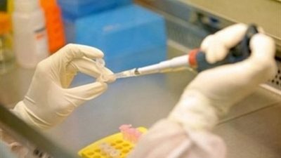 باحثون أمريكيون يكتشفون جزيئا يحمي المخ من تسمم القنب